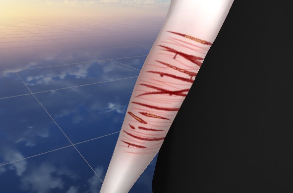 Scar image