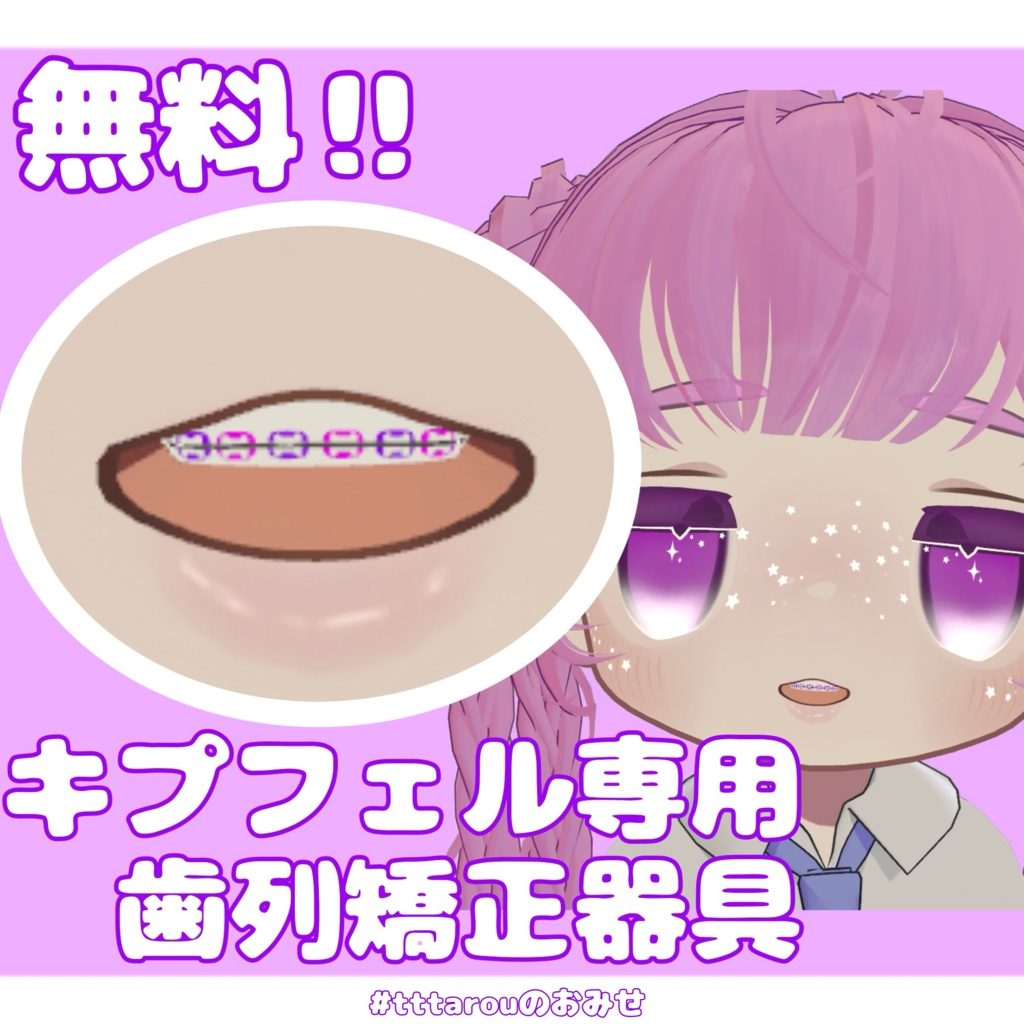 Kipfer-specific orthodontic appliance image